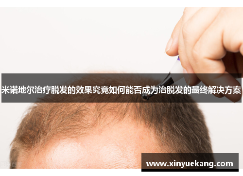 米诺地尔治疗脱发的效果究竟如何能否成为治脱发的最终解决方案 米诺地尔治疗脱发的效果究竟如何能否成为治脱发的最终解决方案